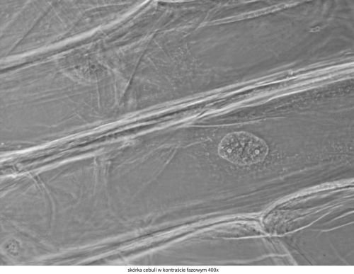 Microscop Delta Optical Genetic Pro Trino Delta-Optical-Genetic-Pro-Bino-11.jpg