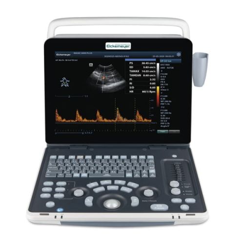 Ecograf mobil Magic 6000 PLUS Mobilne USG weterynaryjne Magic 6000 PLUS – zaawansowane urządzenie diagnostyczne dla małych zwierząt i koni