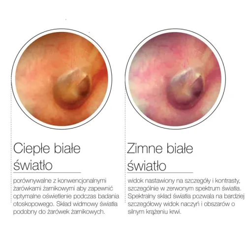 Auris CCT LED Otoscop Luxamed Otoscop otoskop-luxascope-auris-cct-led-dwie-barwy-swiatla (4).webp