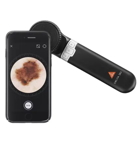 Dermatoscop DELTA 30 Delta30_iphone.webp