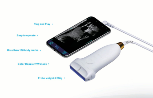 Scaner cu ultrasunete UMAGIC S Landwind Bezprzewodowy ultrasonograf UMAGIC S Landwind do diagnostyki medycznej i weterynaryjnej na smartfonie i tablecie