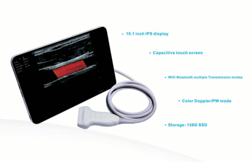 Scaner cu ultrasunete UMAGIC S Landwind Bezprzewodowy ultrasonograf UMAGIC S Landwind do diagnostyki medycznej i weterynaryjnej na smartfonie i tablecie
